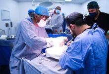 Puebla, donación de órganos, trasplantes, referente nacional